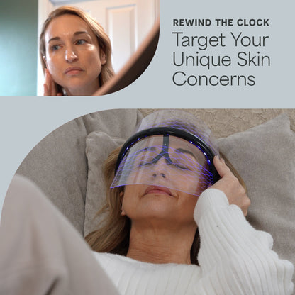 VizaCure LED Face Mask
